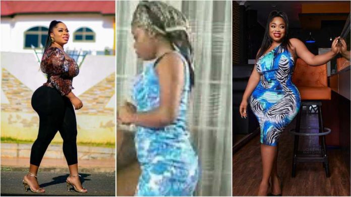 Moesha Boduong before and after plastic surgery
