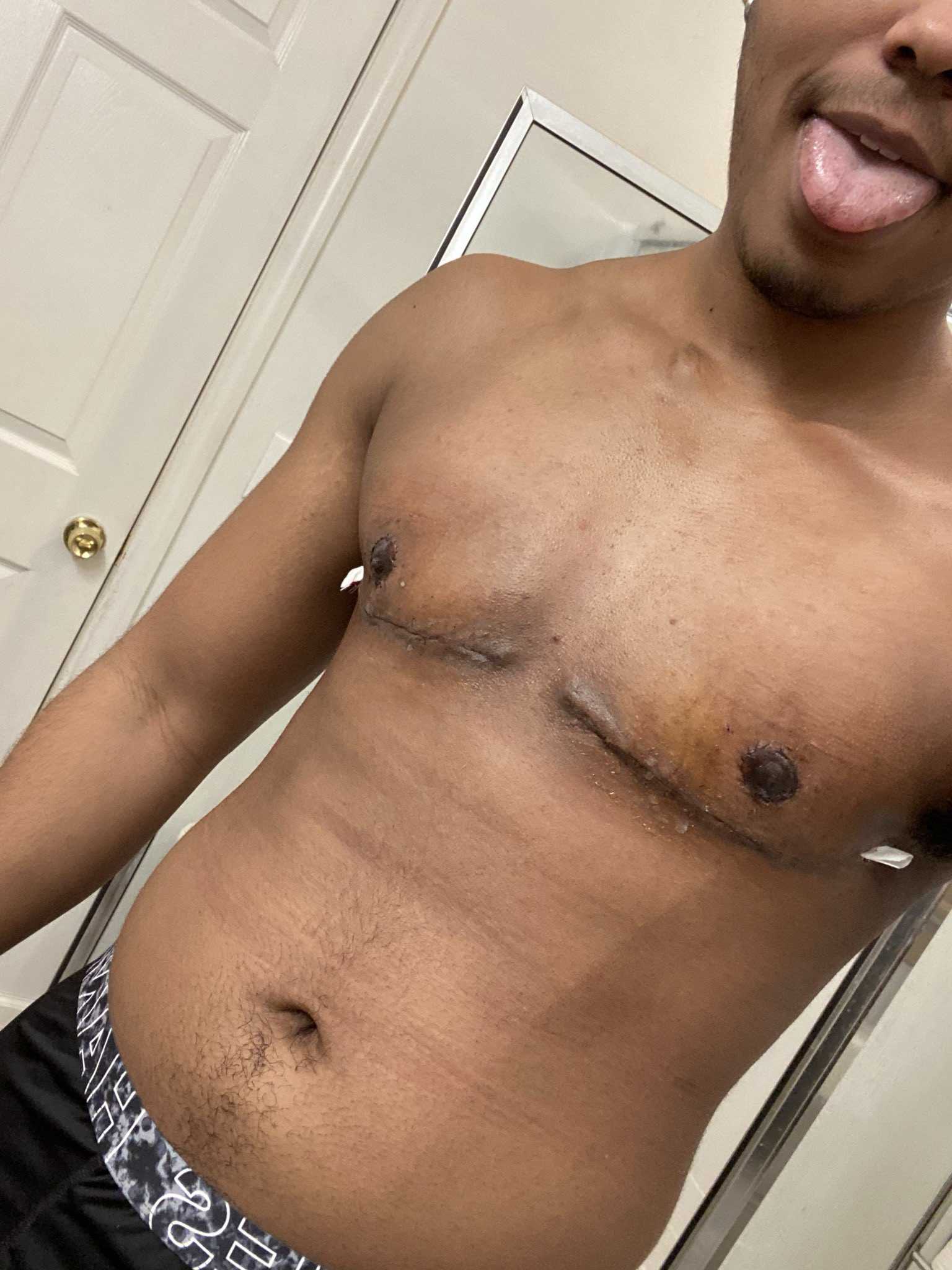 Transgender man proudly shows off his chest 