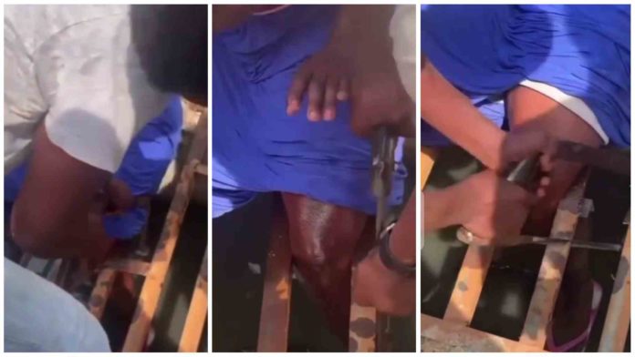 Lady in massive pain as leg enters gutter rails