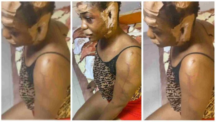 Lady suffers serious injuries after she was allegedly attacked by suspected kidnappers
