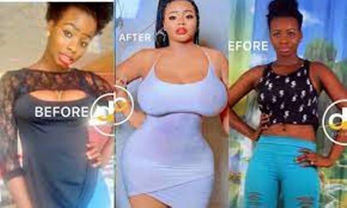 changes of lady arouses suspicions of plastic surgery