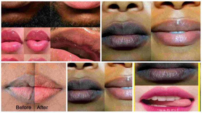 5 easy ways to get your pink lips naturally in 1 week
